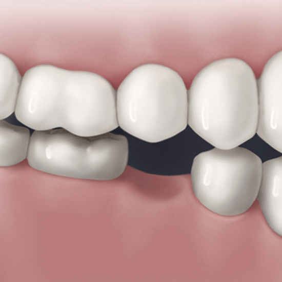 Оценка состояния зубов