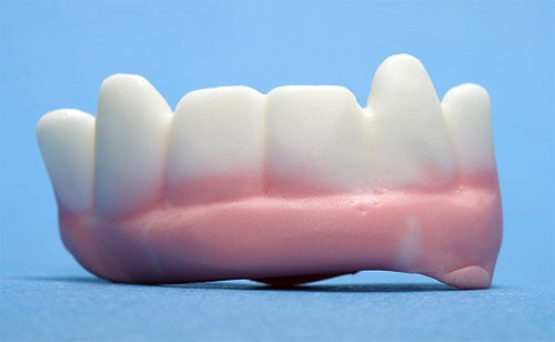 Киста зуба: определение, симптоматика, лечение
