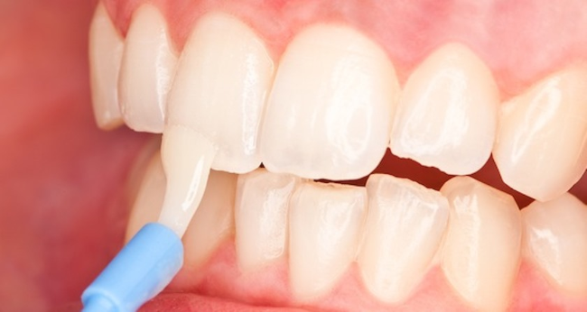 Реминерализации зубной эмали