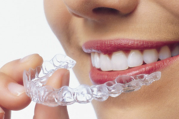 Прозрачные каппы- элайнеры Invisalign (Инвизилайн)