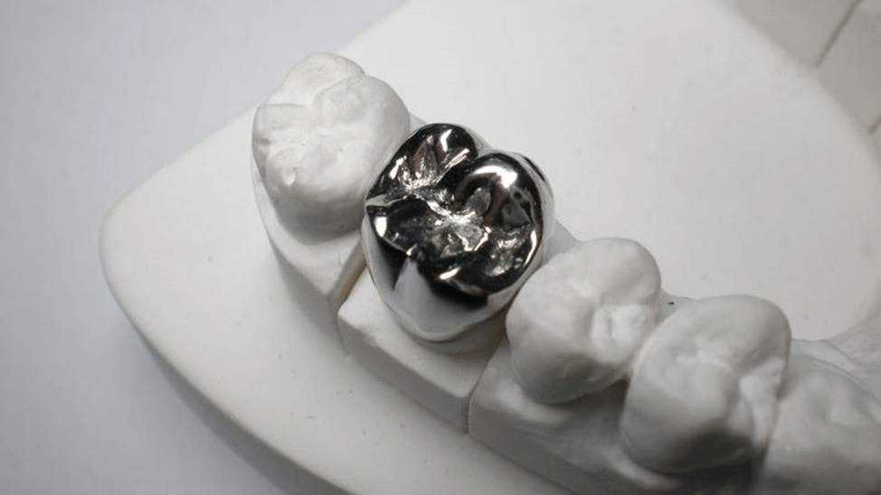 Цельнолитая коронка на жевательный зуб