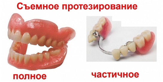 Виды съемочных зубных протезов