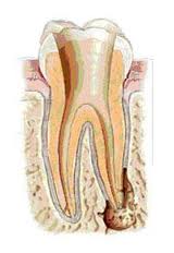 Лечение корневых каналов